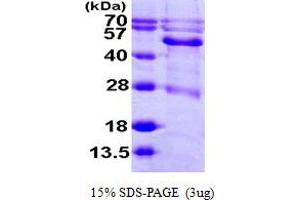 SDS-PAGE (SDS) image for Branched Chain Keto Acid Dehydrogenase E1, alpha Polypeptide (BCKDHA) (AA 46-445) protein (His tag) (ABIN7279351) (BCKDHA Protein (AA 46-445) (His tag))