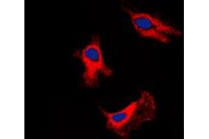 Immunofluorescent analysis of Adenosine A2b Receptor staining in SHSY5Y cells.