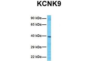 Western Blotting (WB) image for anti-Potassium Channel, Subfamily K, Member 9 (KCNK9) (N-Term) antibody (ABIN2776216)