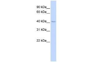 WB Suggested Anti-ZNF174 Antibody Titration: 0. (ZNF174 抗体  (Middle Region))