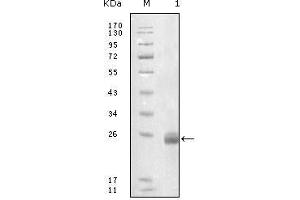 Western Blot showing FBLN5 antibody used against truncated FBLN5-His recombinant protein.