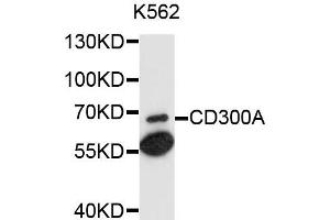 Western blot analysis of extracts of K562 cells, using CD300A antibody. (CD300a 抗体)