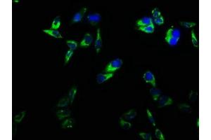 Immunofluorescence staining of Hela cells with ABIN7171365 at 1:166, counter-stained with DAPI. (CD2 抗体  (AA 25-209))