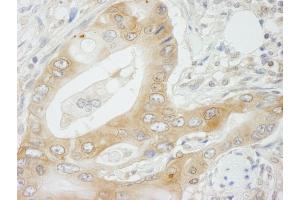 Immunohistochemistry (IHC) image for anti-N-Myc (And STAT) Interactor (NMI) (C-Term) antibody (ABIN7448693) (NMI 抗体  (C-Term))