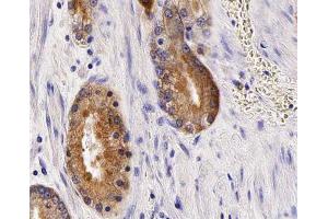 ABIN6266929 at 1/100 staining human Prostate tissue sections by IHC-P. (Anoctamin 7 抗体  (Internal Region))