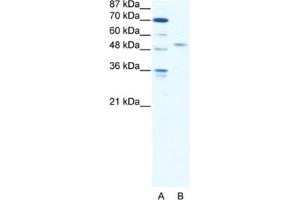 Western Blotting (WB) image for anti-Interferon Regulatory Factor 5 (IRF5) antibody (ABIN2461651) (IRF5 抗体)