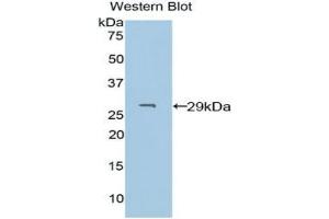 Detection of Recombinant PDXK, Human using Polyclonal Antibody to Pyridoxal Kinase (PDXK) (PDXK 抗体  (AA 29-253))