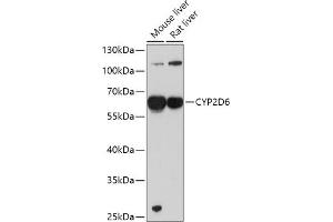 Western blot analysis of extracts of various cell lines, using CYP2D6 antibody (ABIN1512811, ABIN3021880, ABIN3021882 and ABIN6216807) at 1:1000 dilution. (CYP2D6 抗体  (AA 20-230))