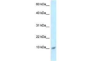 WB Suggested Anti-S100A8 Antibody Titration: 1.