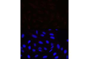 Immunofluorescence analysis of U-2 OS cells using PCNT Rabbit pAb (ABIN7269216) at dilution of 1:100 (40x lens). (PCNT 抗体)