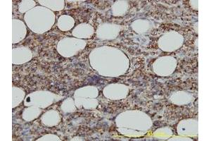 Image no. 1 for anti-Major Histocompatibility Complex, Class II, DM alpha (HLA-DMA) (AA 1-262) antibody (ABIN598734) (HLA-DMA 抗体  (AA 1-262))
