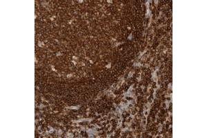 Immunohistochemical staining of human lymph node with RUNDC1 polyclonal antibody  shows strong cytoplasmic positivity in reaction center cells and lymphoid cells outside reaction centra at 1:20-1:50 dilution. (RUNDC1 抗体)