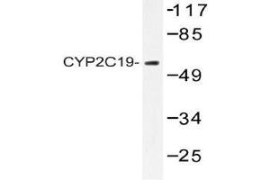 Western blot analysis of CYP2C19 antibody in extracts from 293 cells. (CYP2C19 抗体)