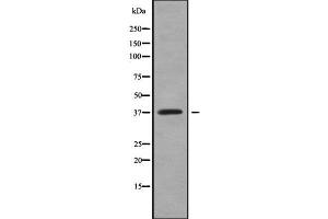 Western blot analysis of AKR1C4 using K562 whole cell lysates (AKR1C4 抗体)