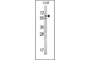 Western blot analysis of RIOK2 Center in CEM cell line lysates (35ug/lane) (RIOK2 抗体  (AA 270-299))