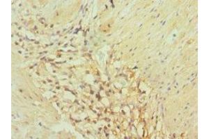 Immunohistochemistry of paraffin-embedded human gallbladder tissue using ABIN7143694 at dilution of 1:100