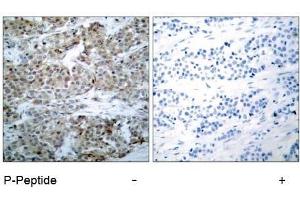 Image no. 1 for anti-BCL2-Associated Agonist of Cell Death (BAD) (pSer112), (pSer75) antibody (ABIN196734) (BAD 抗体  (pSer75, pSer112))