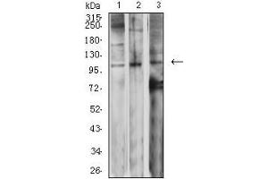 Western blot analysis using GRM2 mouse mAb against SK-N-SH (1), Jurkat (2), and SW620 (3) cell lysate. (GRM2 抗体  (AA 414-558))