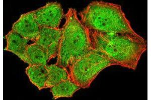 Immunofluorescence analysis of Hela cells using NS1 mouse mAb (green). (Parvovirus B19 NS1 (AA 1-216) 抗体)
