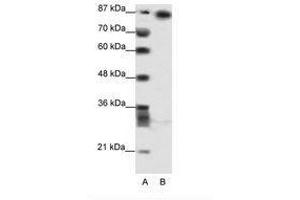 Image no. 1 for anti-Myoneurin (MYNN) (AA 281-330) antibody (ABIN202812) (Myoneurin 抗体  (AA 281-330))
