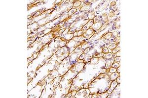 Immunohistochemistry of paraffin embedded mouse stomach using SLC7A8 (ABIN7074503) at dilution of 1:1100 (400x lens) (LAT2 抗体)