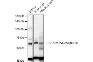 Western blot analysis of extracts of various cell lines, using TGF beta induced (TGFBI) antibody (ABIN6128864, ABIN6149078, ABIN6149080 and ABIN6215116) at 1:1000 dilution. (TGFBI 抗体  (AA 481-683))