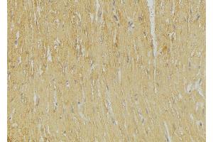 ABIN6269251 at 1/100 staining Mouse muscle tissue by IHC-P. (GRIA2 抗体  (C-Term))