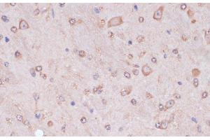 Immunohistochemistry of paraffin-embedded Mouse brain using CARTPT Polyclonal Antibody at dilution of 1:100 (40x lens). (CARTPT 抗体)