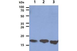 The Cell lysates (40ug) were resolved by SDS-PAGE, transferred to PVDF membrane and probed with anti-human LSM5 antibody (1:1000). (LSM5 抗体)