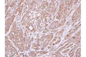 IHC-P Image Immunohistochemical analysis of paraffin-embedded A549 xenograft , using HSD3B2, antibody at 1:100 dilution. (HSD3B2 抗体)