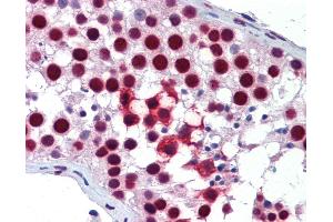 Immunohistochemistry (IHC) image for anti-KH Domain Containing, RNA Binding, Signal Transduction Associated 1 (KHDRBS1) (AA 359-408) antibody (ABIN6747056)