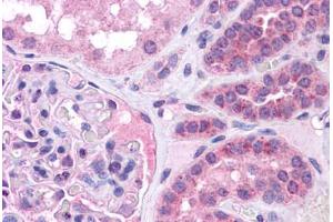 Human Kidney: Formalin-Fixed, Paraffin-Embedded (FFPE) (MAF 抗体  (N-Term))