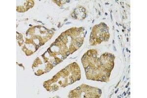 Immunohistochemistry of paraffin-embedded Human esophagus using PI3 Polyclonal Antibody at dilution of 1:100 (40x lens). (PI3 抗体)
