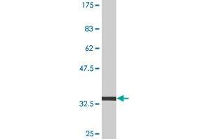 Western Blot detection against Immunogen (34.