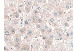 DAB staining on IHC-P; Samples: Human Liver Tissue (SPAG1 抗体  (AA 1-365))