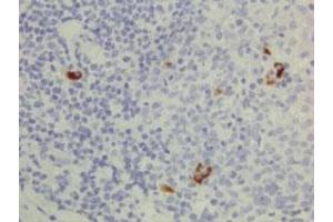 Immunohistochemical staining (Formalin-fixed paraffin-embedded sections) of human lymphoid tissue with Human IgG3 monoclonal antibody, clone RM119 (Biotin) . (兔 anti-人 IgG3 Antibody (Biotin))