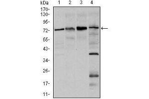 Western blot analysis using FOXO1 mouse mAb against Hela (1), HEK293 (2), MCF-7(3), and C6 (4) cell lysate. (FOXO1 抗体)
