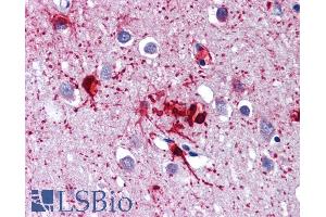 Immunohistochemistry (IHC) image for anti-DEAD (Asp-Glu-Ala-Asp) Box Polypeptide 58 (DDX58) (C-Term) antibody (ABIN6391376)