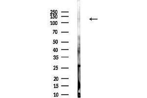 Western blot analysis of lysates from Rat brain, using NRCAM Antibody at 1/1000 dilution.