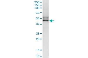 Immunoprecipitation of SGK196 transfected lysate using anti-SGK196 MaxPab rabbit polyclonal antibody and Protein A Magnetic Bead , and immunoblotted with SGK196 MaxPab mouse polyclonal antibody (B01) . (SGK196 抗体  (AA 1-350))