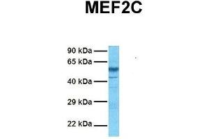 Host:  Rabbit  Target Name:  MEF2C  Sample Tissue:  Human Fetal Brain  Antibody Dilution:  1. (MEF2C 抗体  (N-Term))