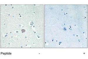 Immunohistochemistry analysis of paraffin-embedded human brain tissue using ADORA2A polyclonal antibody . (Adenosine A2a Receptor 抗体)