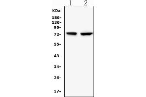Western blot analysis of GUSB using anti-GUSB antibody (ABIN7599854).