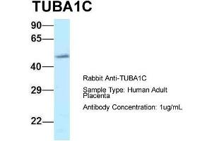 Host: Rabbit  Target Name: TUBA1C  Sample Tissue: Human Adult Placenta  Antibody Dilution: 1. (TUBA1C 抗体  (C-Term))