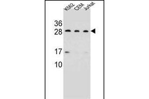 CD79A Antibody (C-term) (ABIN656983 and ABIN2846166) western blot analysis in K562,CEM,Jurkat cell line lysates (35 μg/lane). (CD79a 抗体  (C-Term))