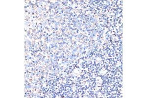 Immunohistochemistry (IHC) image for anti-CD44 (CD44) (AA 35-300) antibody (ABIN3021913)
