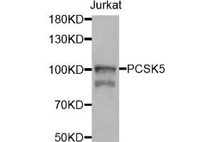 Western blot analysis of extracts of jurkat cells, using PCSK5 antibody. (PCSK5 抗体)