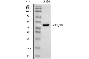Western blot analysis of TMEFF2 using anti-TMEFF2 antibody (ABIN7602460).