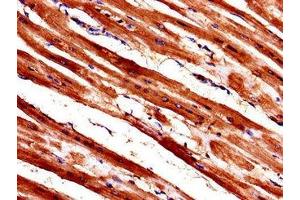 Immunohistochemistry of paraffin-embedded human heart tissue using ABIN7175846 at dilution of 1:100 (WISP1 抗体  (AA 130-251))