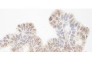 Immunohistochemistry (IHC) image for anti-SIN3 homolog A, transcription regulator (SIN3A) (AA 1-50) antibody (ABIN7448796) (SIN3A 抗体  (AA 1-50))
